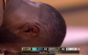 LeBron head injury Finals